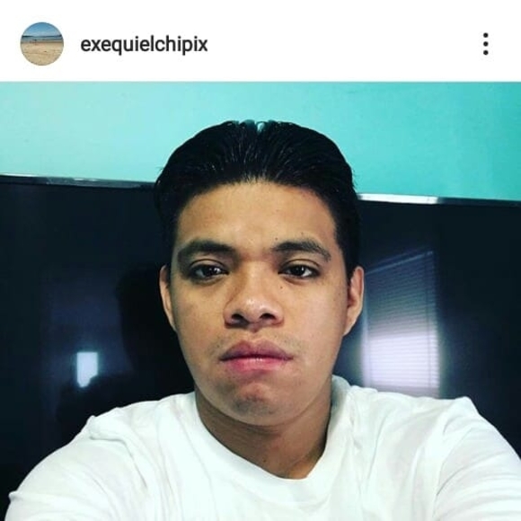 exequielchipix